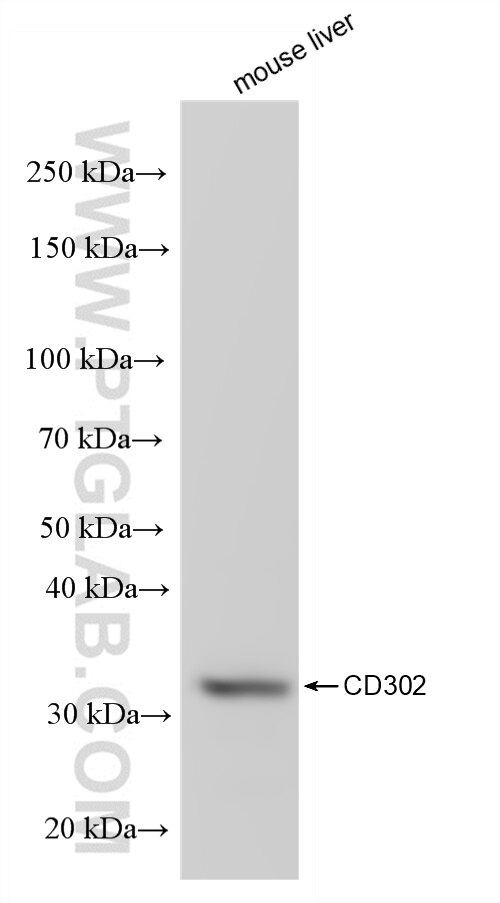 Western Blot (WB) analysis of various lysates using CD302 Recombinant antibody (85813-5-RR)