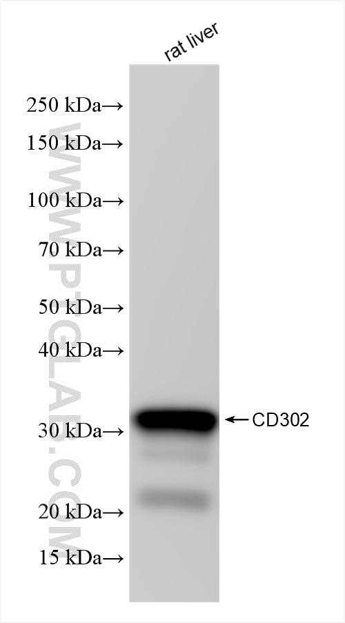 Western Blot (WB) analysis of rat liver tissue using CD302 Recombinant antibody (85813-5-RR)