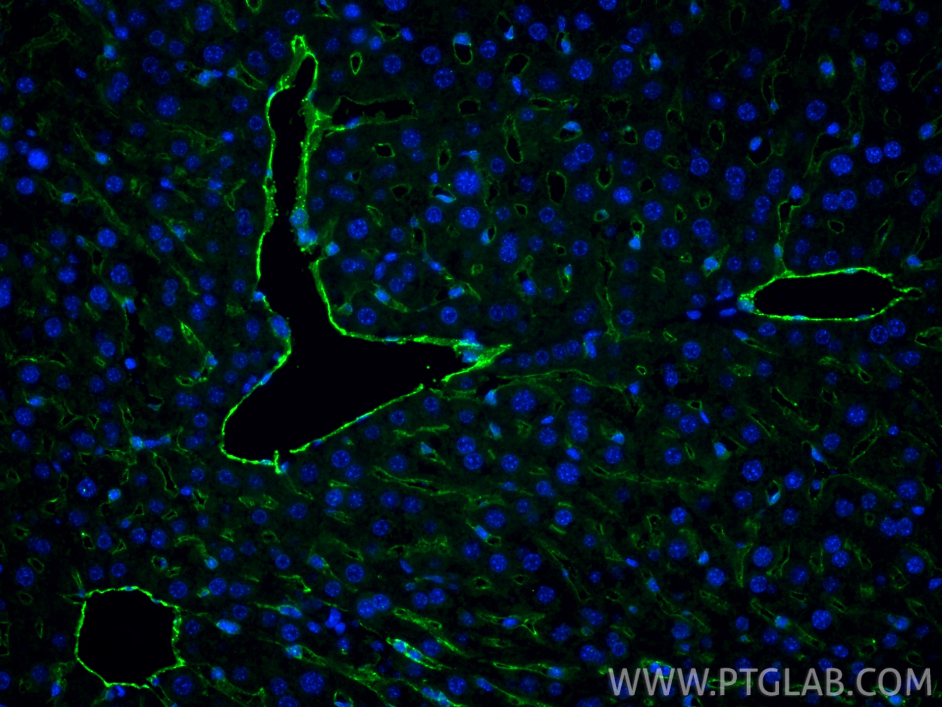 Immunofluorescence (IF) / fluorescent staining of mouse liver tissue using CD31 Polyclonal antibody (32387-1-AP)