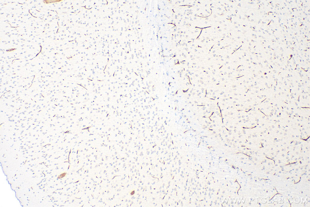 Immunohistochemistry (IHC) staining of mouse brain tissue using CD31 Polyclonal antibody (32387-1-AP)