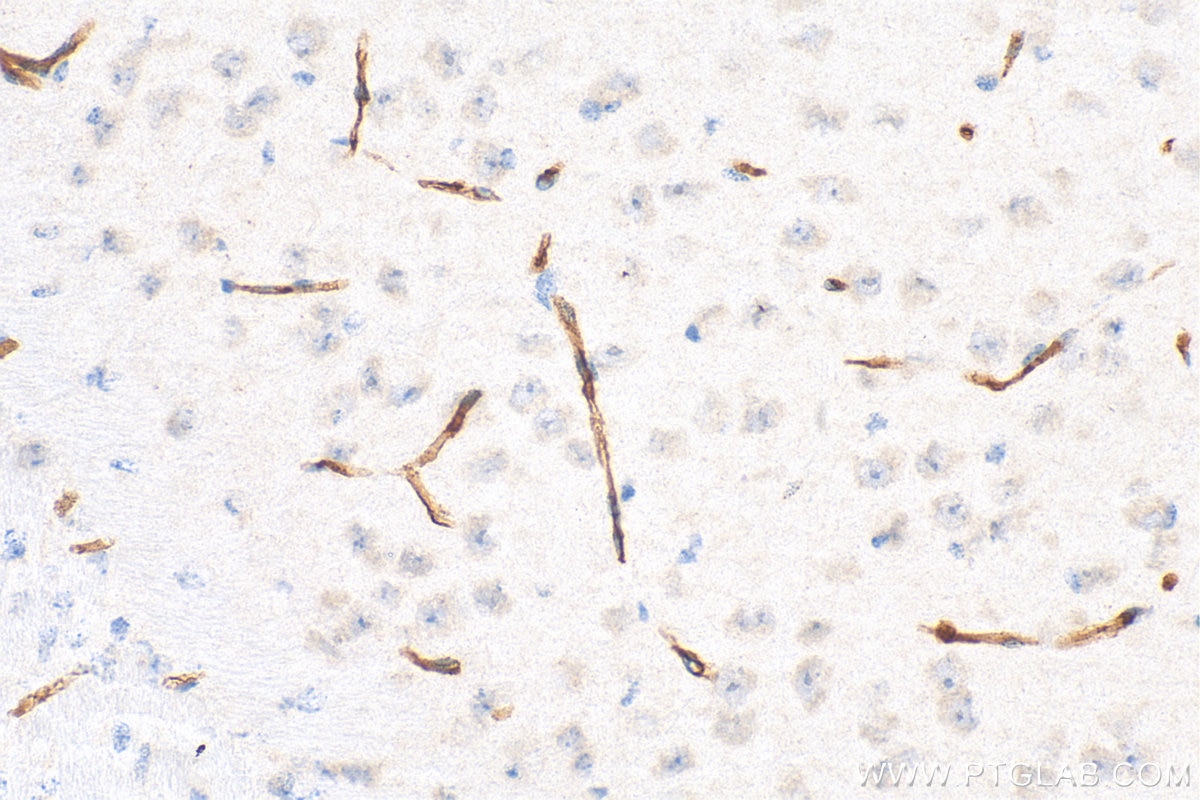 CD31