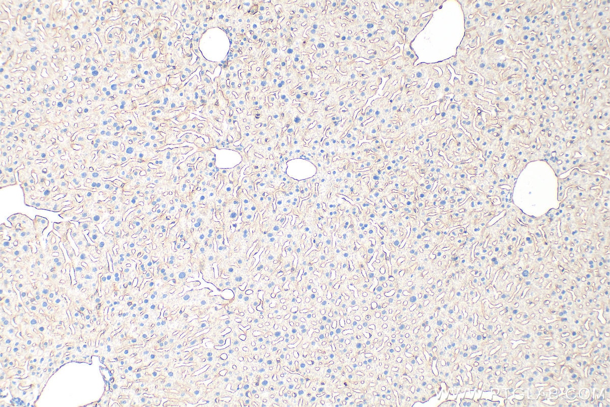 Immunohistochemistry (IHC) staining of mouse liver tissue using CD31 Polyclonal antibody (32387-1-AP)
