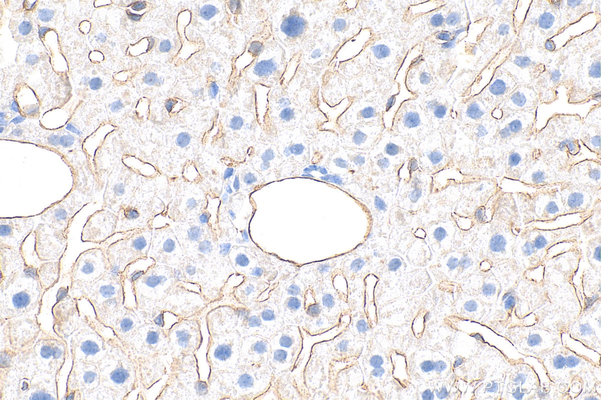Immunohistochemistry (IHC) staining of mouse liver tissue using CD31 Polyclonal antibody (32387-1-AP)
