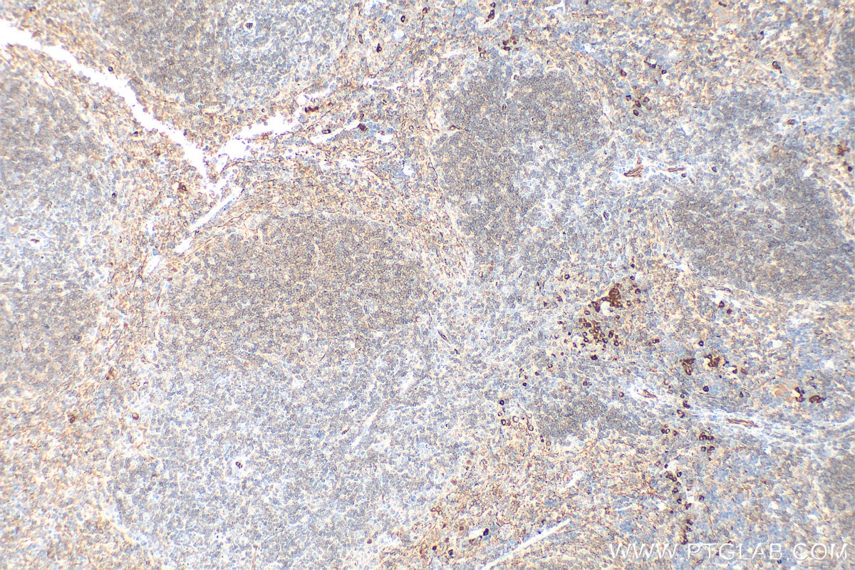 Immunohistochemistry (IHC) staining of mouse spleen tissue using CD31 Polyclonal antibody (32387-1-AP)