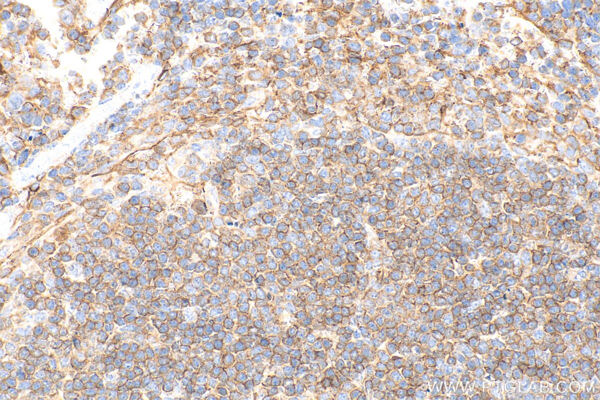 Immunohistochemistry (IHC) staining of mouse spleen tissue using CD31 Polyclonal antibody (32387-1-AP)