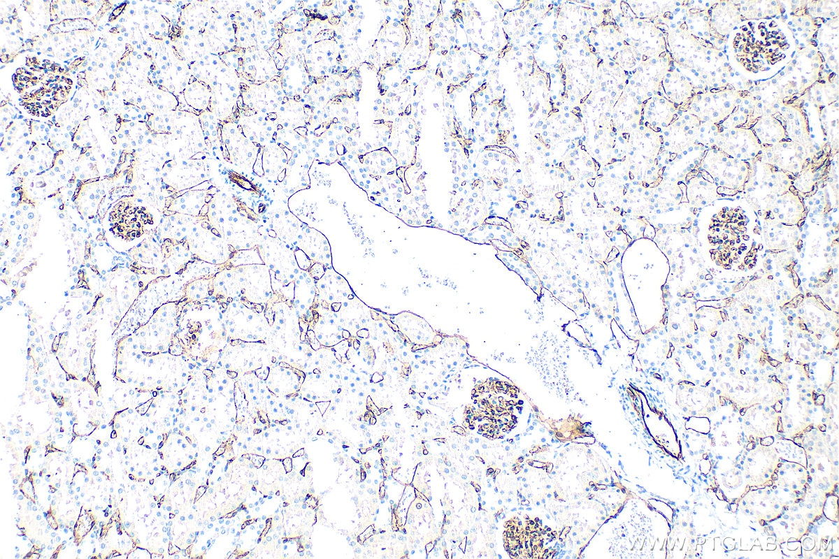 Immunohistochemistry (IHC) staining of rat kidney tissue using CD31 Polyclonal antibody (33075-1-AP)