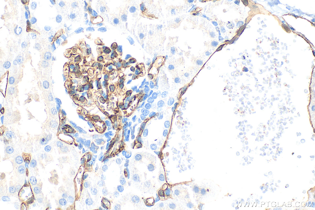 Immunohistochemistry (IHC) staining of rat kidney tissue using CD31 Polyclonal antibody (33075-1-AP)