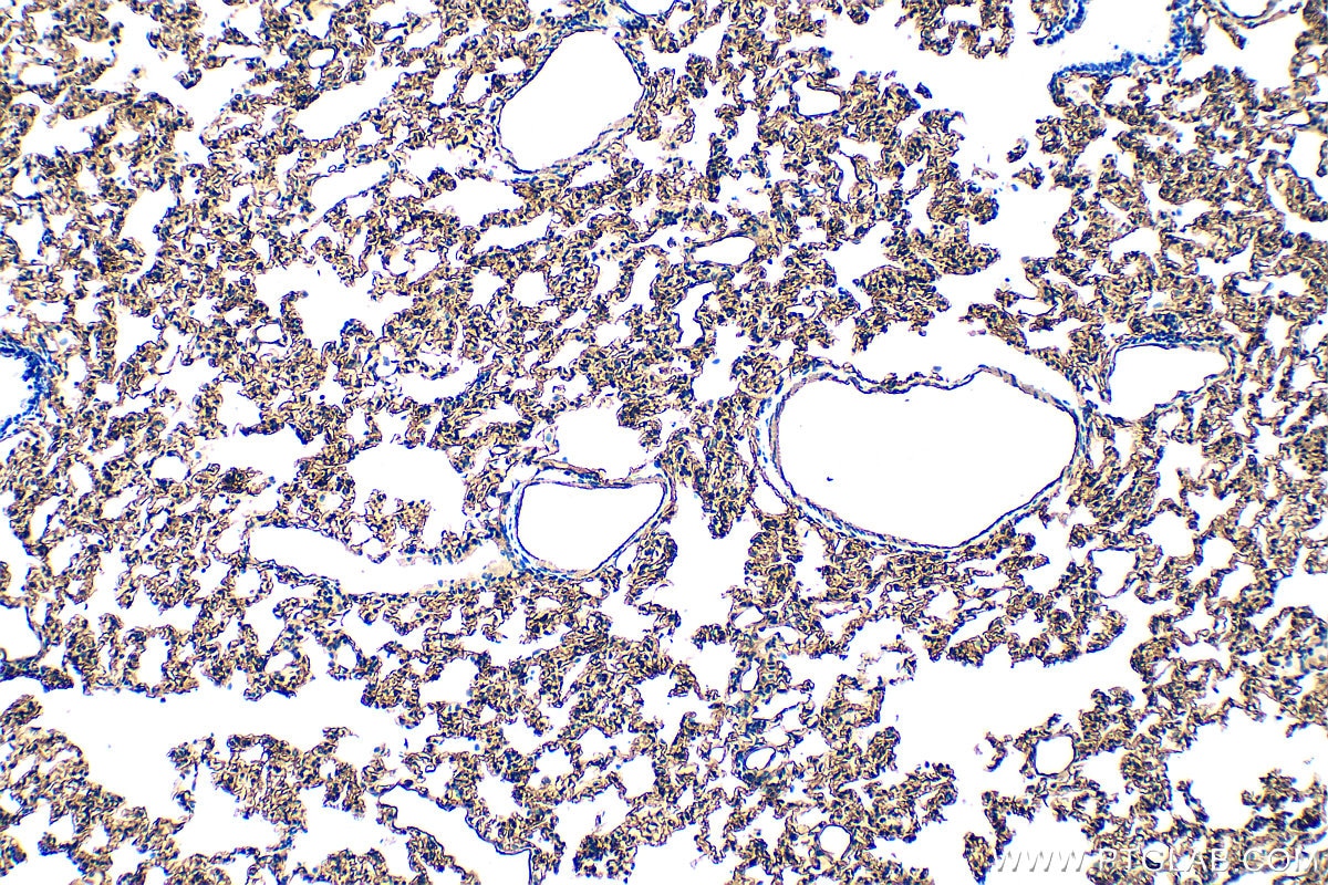 Immunohistochemistry (IHC) staining of rat lung tissue using CD31 Polyclonal antibody (33075-1-AP)