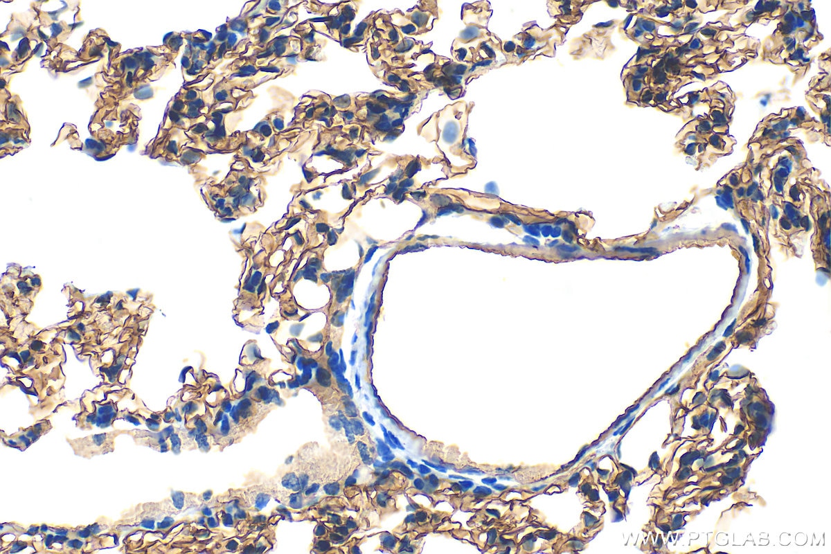 Immunohistochemistry (IHC) staining of rat lung tissue using CD31 Polyclonal antibody (33075-1-AP)