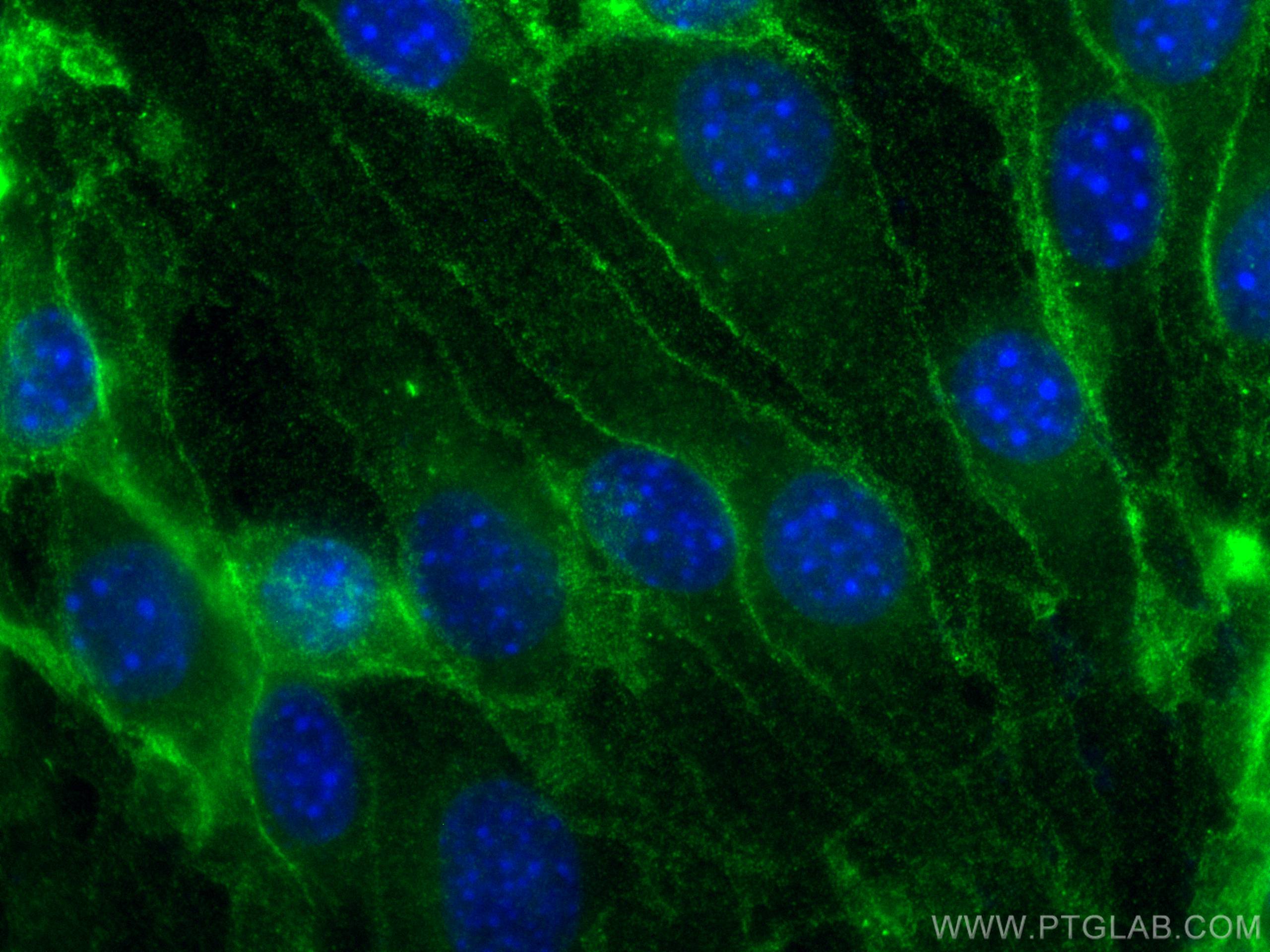 Immunofluorescence (IF) / fluorescent staining of bEnd.3 cells using Anti-Mouse CD31 (390) (65058-1-Ig)