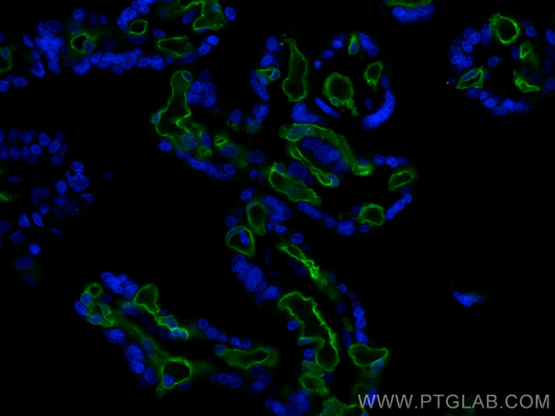 Immunofluorescence (IF) / fluorescent staining of human placenta tissue using CD31 Monoclonal antibody (66065-2-Ig)