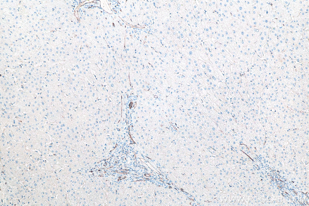 IHC staining of human liver using 66065-2-Ig Immunohistochemistry (IHC) staining of human liver tissue using CD31 Monoclonal antibody (66065-2-Ig)