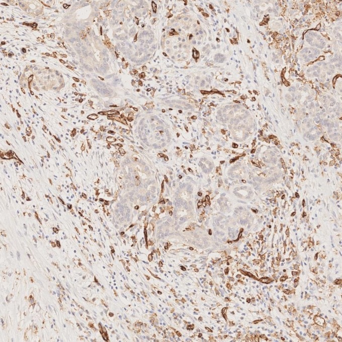 Immunohistochemistry (IHC) staining of human pancreas tissue using CD31 Monoclonal antibody (66065-2-Ig)