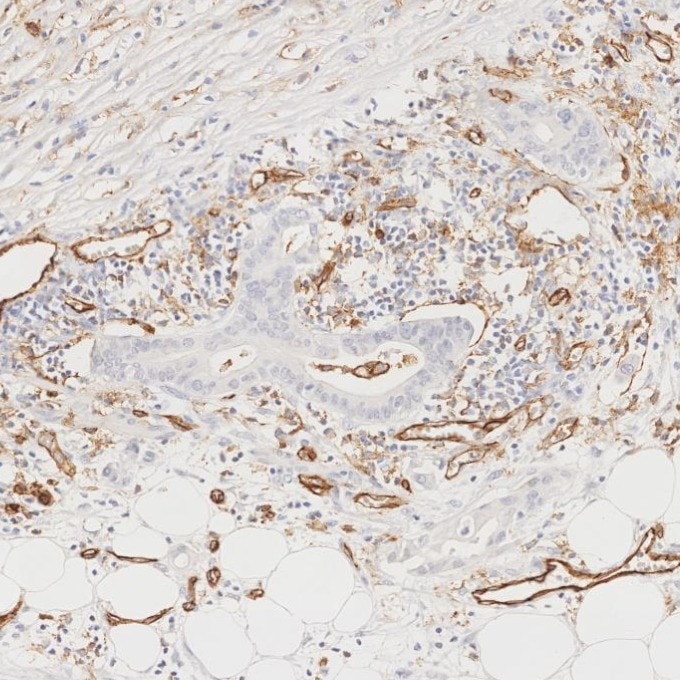 Immunohistochemistry (IHC) staining of human pancreas tissue using CD31 Monoclonal antibody (66065-2-Ig)