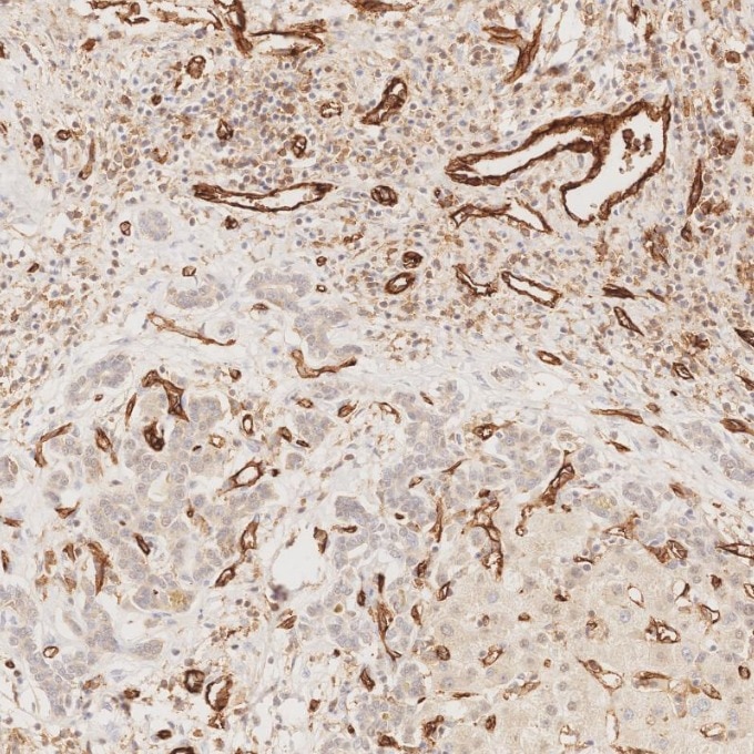 Immunohistochemistry (IHC) staining of human liver tissue using CD31 Monoclonal antibody (66065-2-Ig)