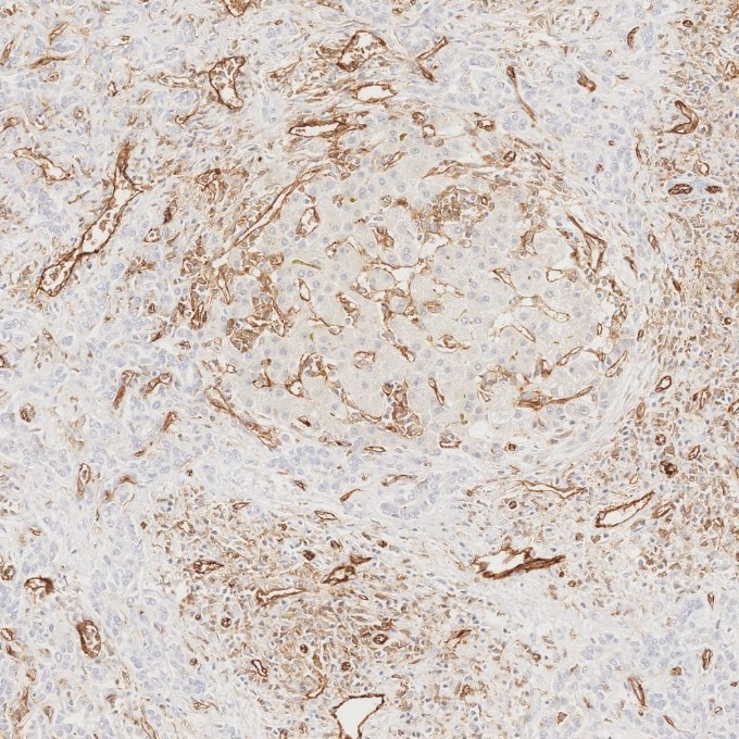 Immunohistochemistry (IHC) staining of human liver tissue using CD31 Monoclonal antibody (66065-2-Ig)