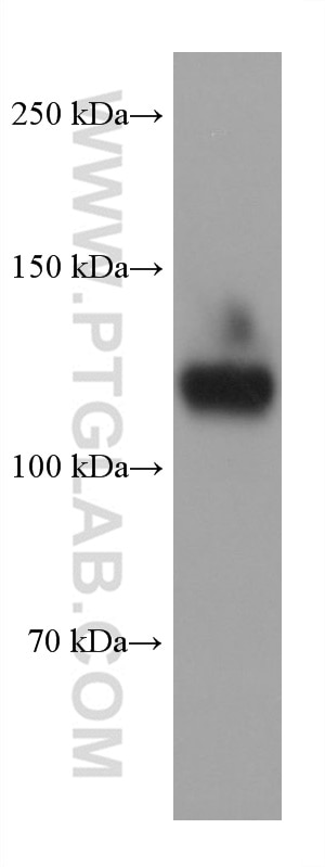 Western Blot (WB) analysis of Jurkat cells using CD31 Monoclonal antibody (66065-2-Ig)
