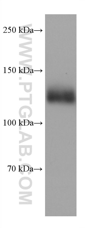 Western Blot (WB) analysis of THP-1 cells using CD31 Monoclonal antibody (66065-2-Ig)
