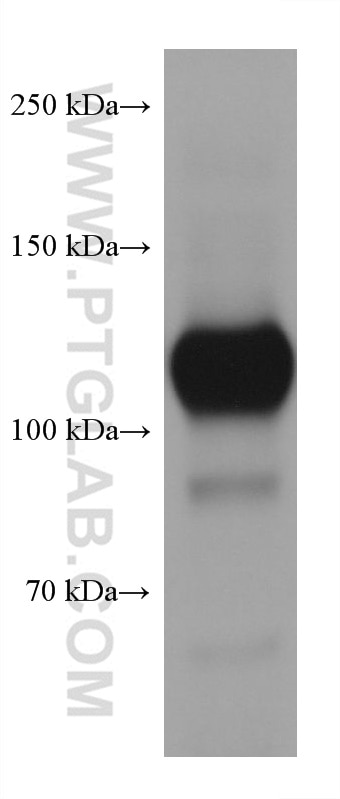 Western Blot (WB) analysis of human peripheral blood platelets using CD31 Monoclonal antibody (66065-2-Ig)