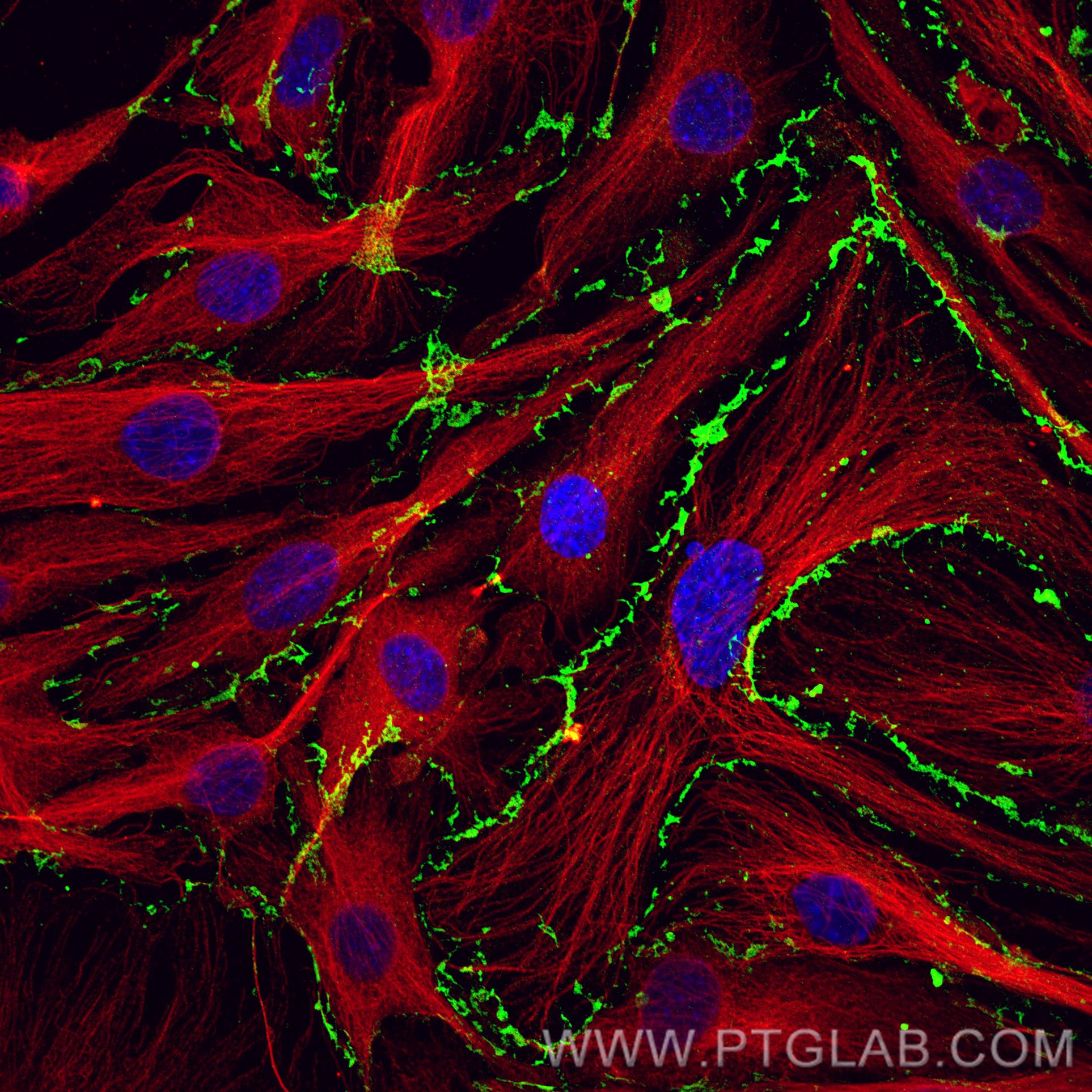 Immunofluorescence (IF) / fluorescent staining of bEnd.3 cells using CD31 Recombinant antibody (80530-1-RR)