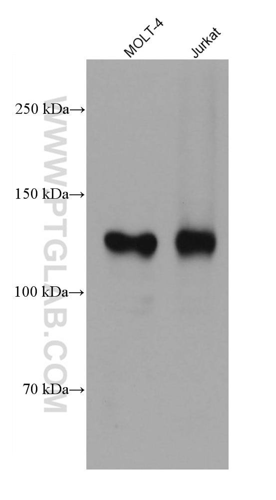 Western Blot (WB) analysis of various lysates using CD31 Recombinant antibody (80530-1-RR)