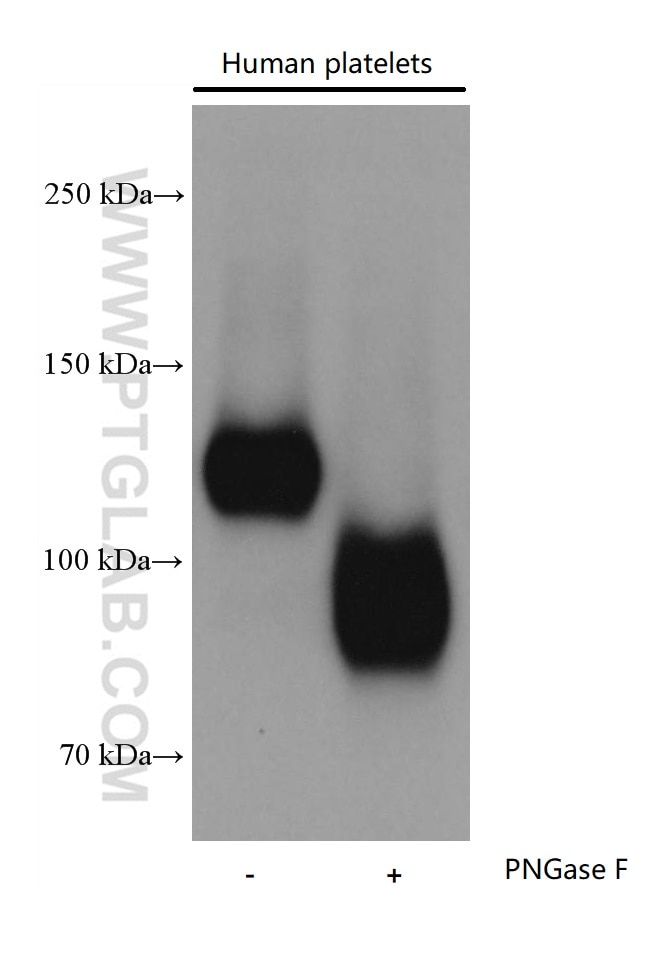 Western Blot (WB) analysis of various lysates using CD31 Recombinant antibody (80530-1-RR)