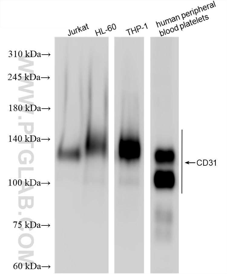 Western Blot (WB) analysis of various lysates using CD31 Recombinant antibody (80773-4-RR)