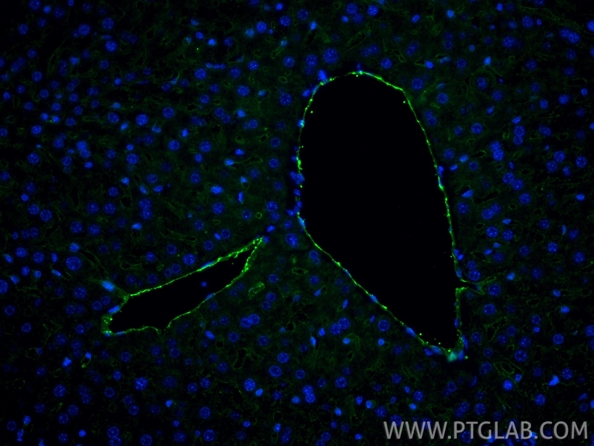 Immunofluorescence (IF) / fluorescent staining of mouse liver tissue using CD31 Recombinant monoclonal antibody (84607-4-RR)
