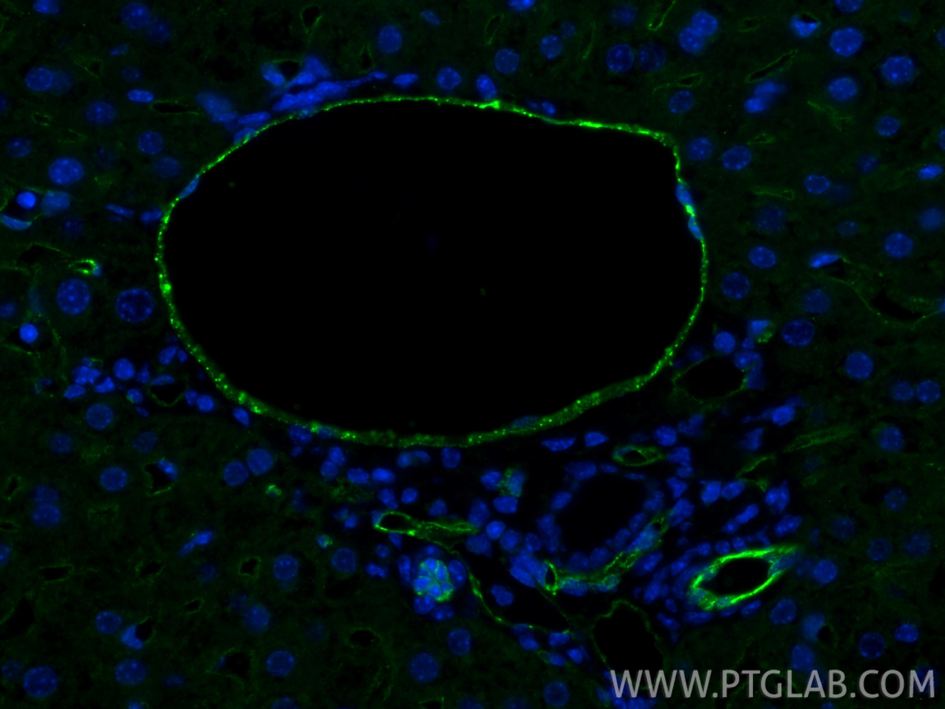 Immunofluorescence (IF) / fluorescent staining of mouse liver tissue using CD31 Recombinant monoclonal antibody (84607-4-RR)