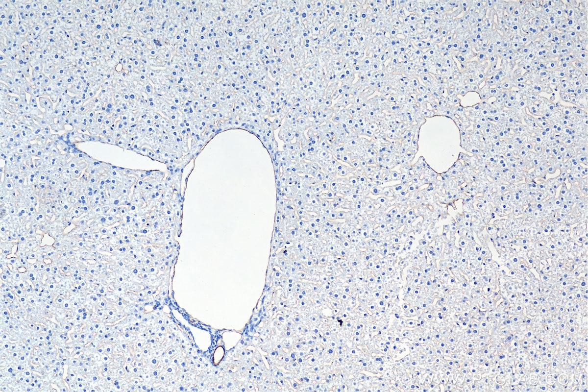 Immunohistochemistry (IHC) staining of mouse liver tissue using CD31 Recombinant antibody (84607-4-RR)