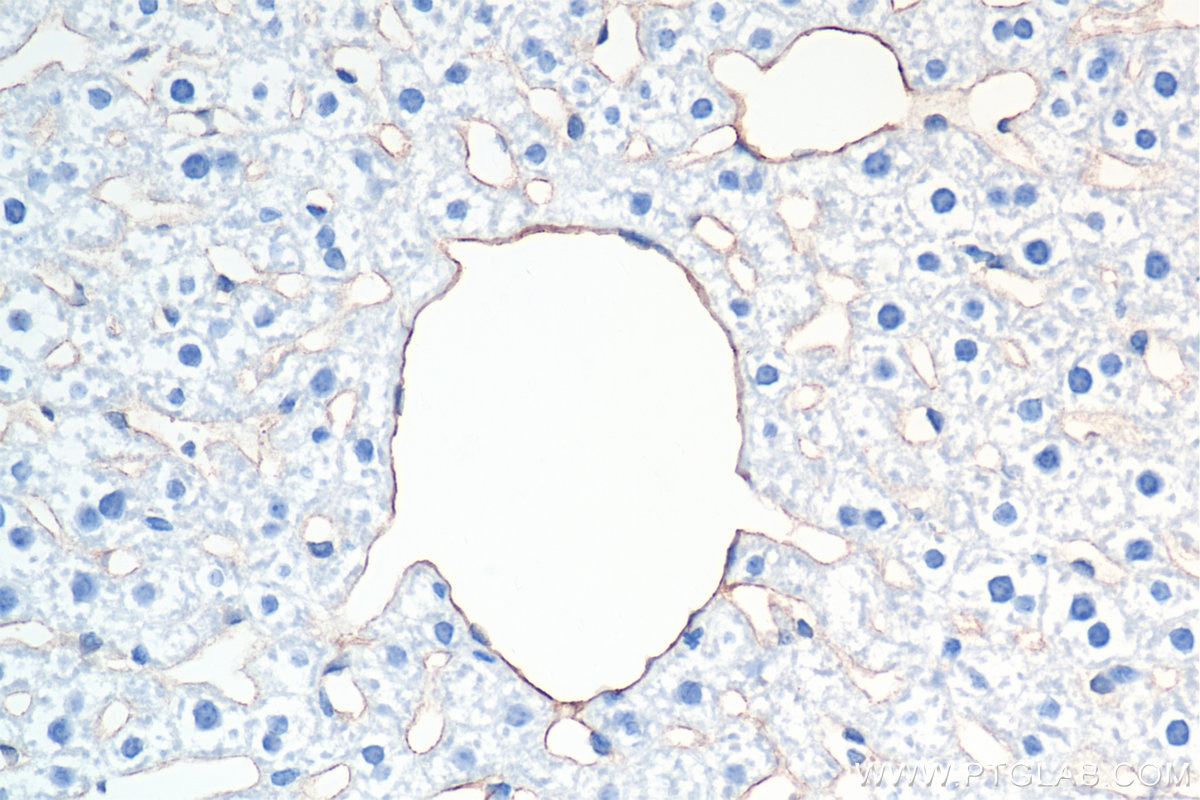 Immunohistochemistry (IHC) staining of mouse liver tissue using CD31 Recombinant antibody (84607-4-RR)