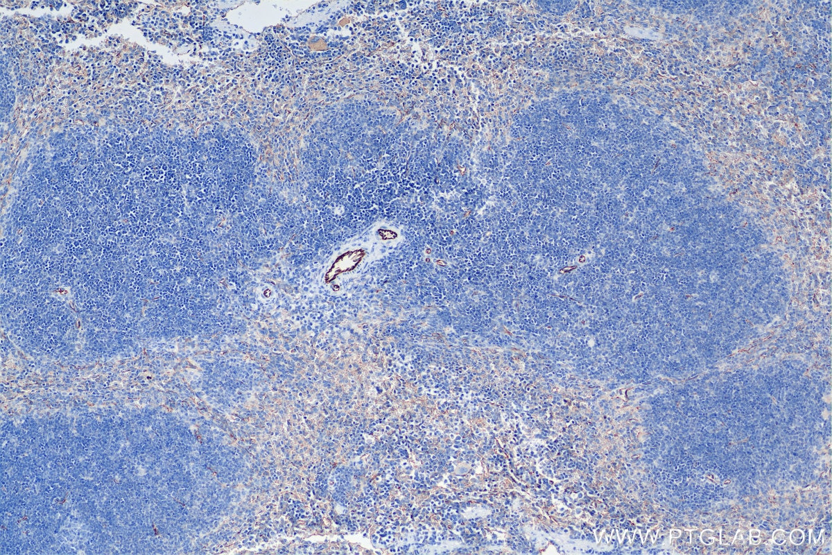 Immunohistochemistry (IHC) staining of mouse spleen tissue using CD31 Recombinant antibody (84607-4-RR)