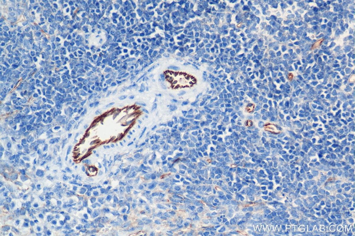 Immunohistochemistry (IHC) staining of mouse spleen tissue using CD31 Recombinant antibody (84607-4-RR)