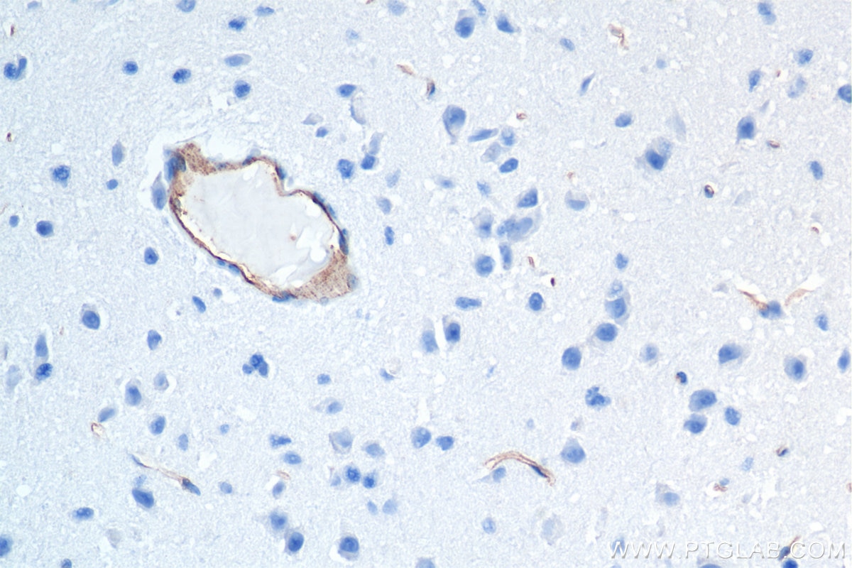 Immunohistochemistry (IHC) staining of mouse brain tissue using CD31 Recombinant antibody (84607-4-RR)