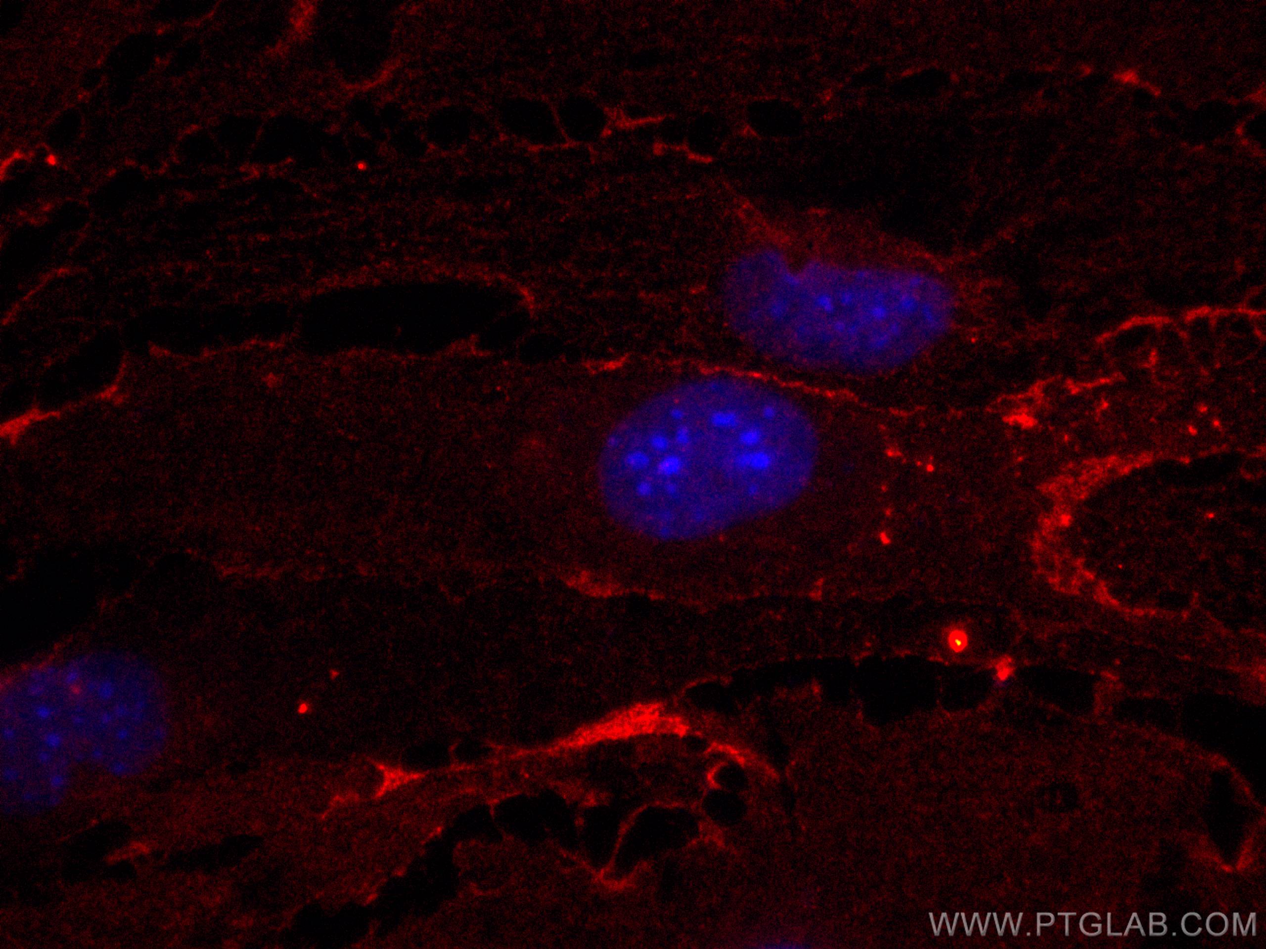 Immunofluorescence (IF) / fluorescent staining of bEnd.3 cells using APC Anti-Mouse CD31 (390) (APC-65058)