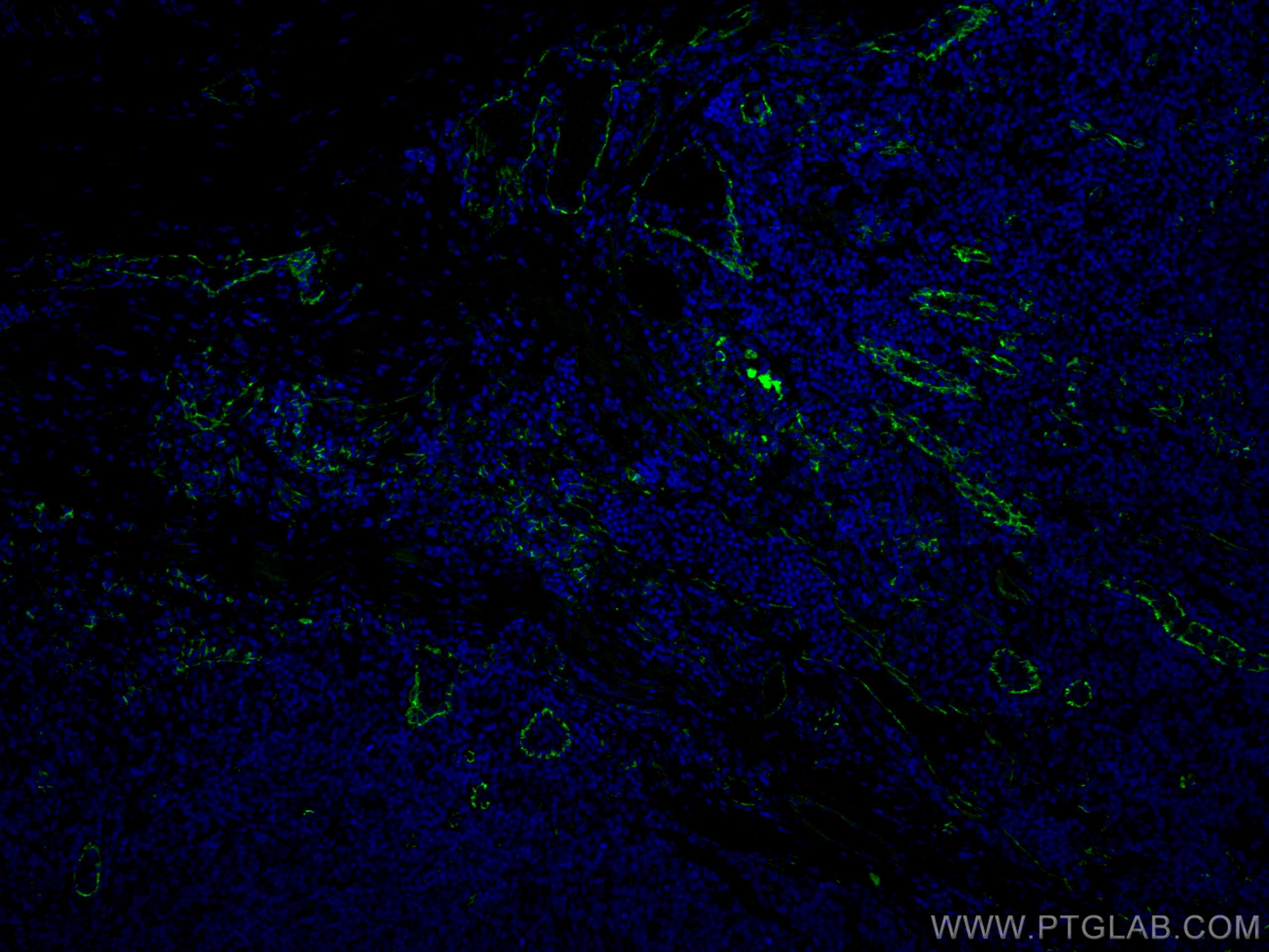 Immunofluorescence (IF) / fluorescent staining of human tonsillitis tissue using CoraLite® Plus 488-conjugated CD31 Polyclonal anti (CL488-11265)