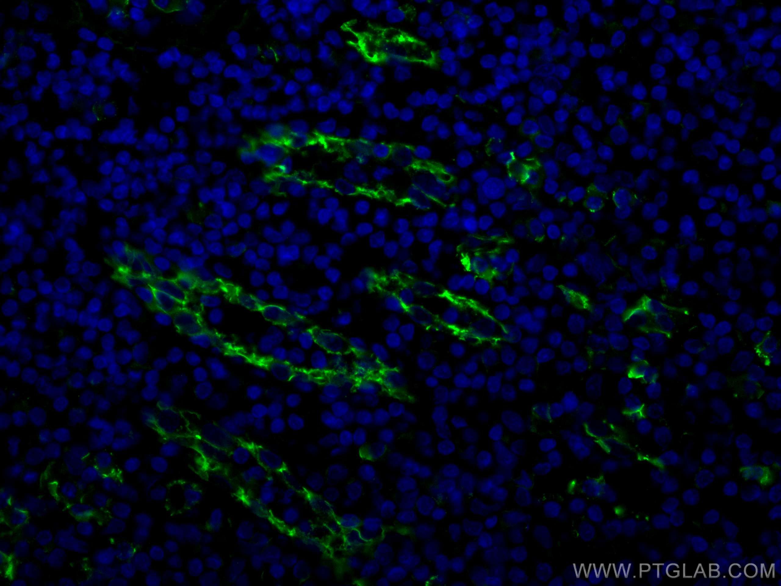 Immunofluorescence (IF) / fluorescent staining of human tonsillitis tissue using CoraLite® Plus 488-conjugated CD31 Polyclonal anti (CL488-11265)