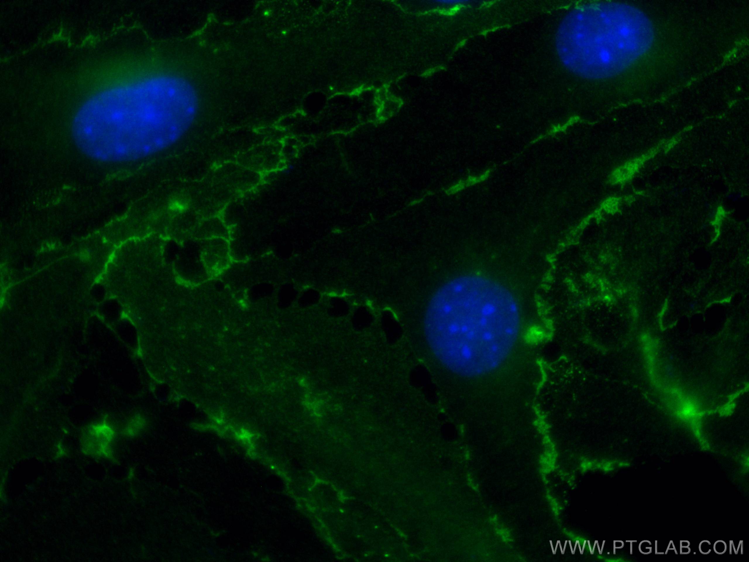 Immunofluorescence (IF) / fluorescent staining of bEnd.3 cells using CoraLite® Plus 488 Anti-Mouse CD31 (390) (CL488-65058)