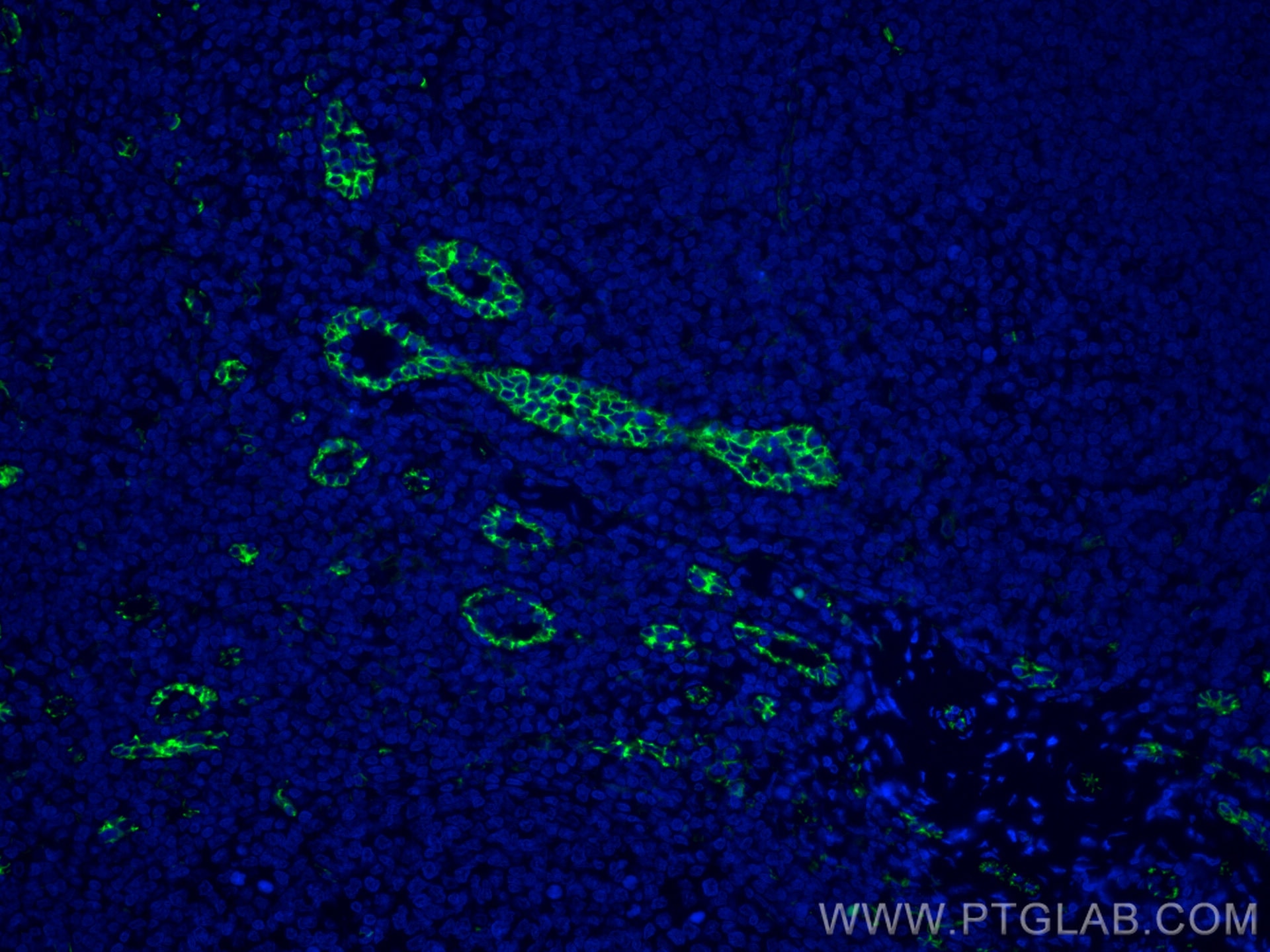 Immunofluorescence (IF) / fluorescent staining of human tonsillitis tissue using CoraLite® Plus 488-conjugated CD31 Monoclonal anti (CL488-66065)