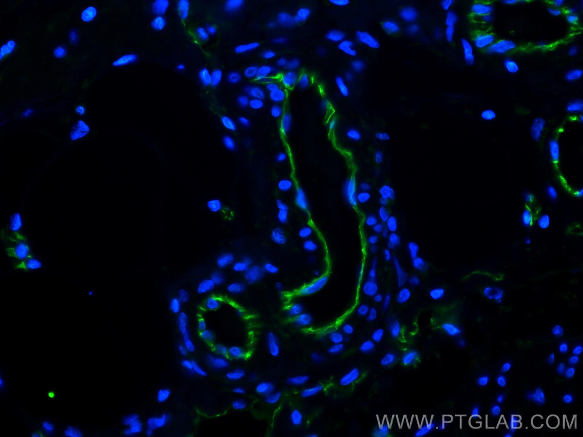 Immunofluorescence (IF) / fluorescent staining of human colon cancer tissue using CoraLite® Plus 488-conjugated CD31 Monoclonal anti (CL488-66065)