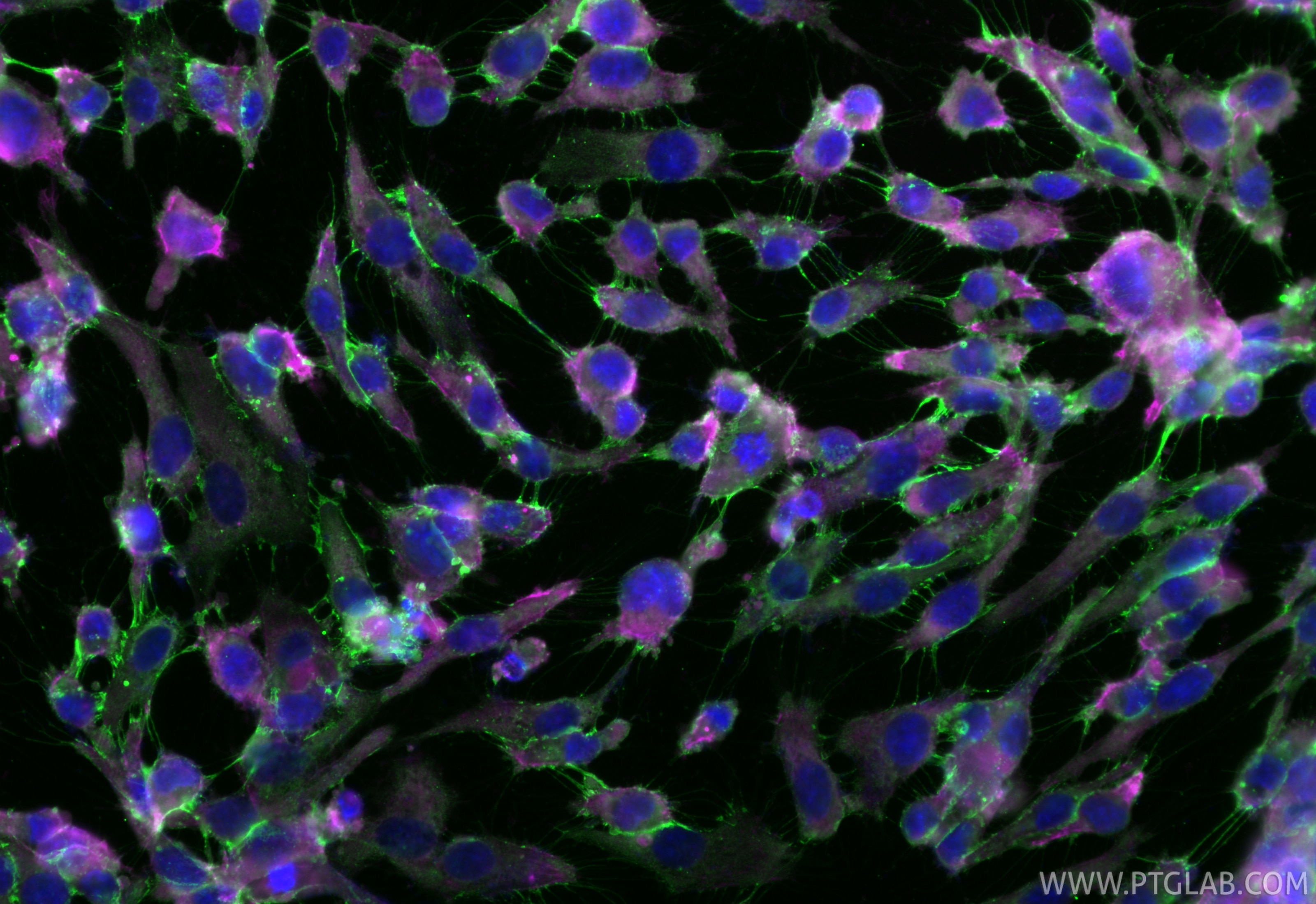 Immunofluorescence (IF) / fluorescent staining of HUVEC cells using CoraLite® Plus 488-conjugated CD31 Monoclonal anti (CL488-66065)