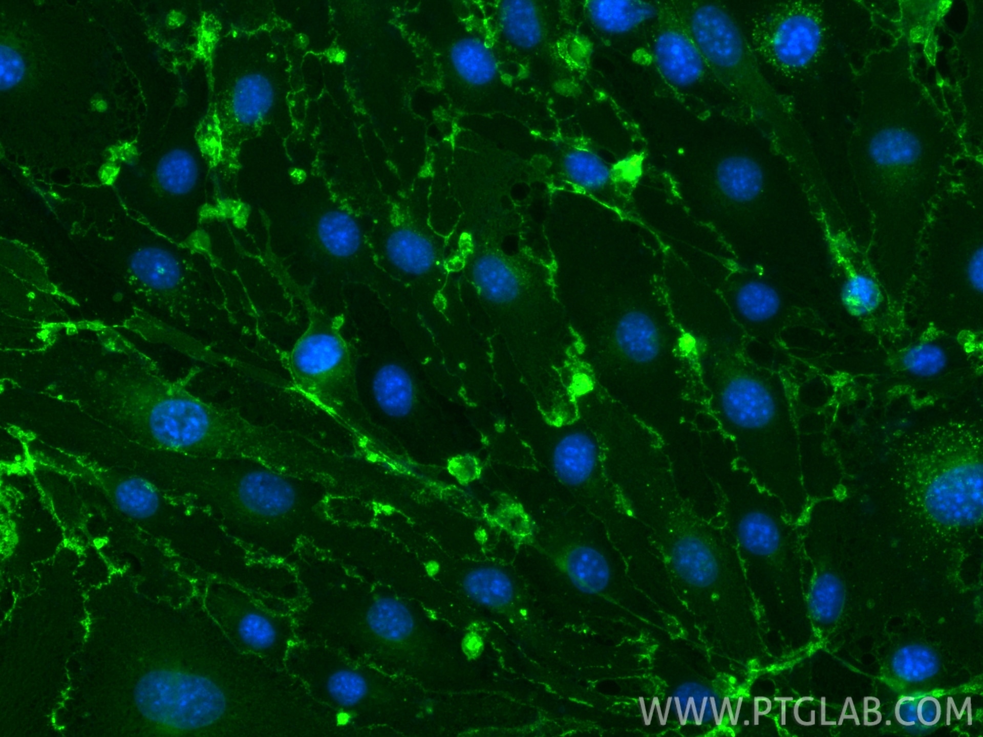 Immunofluorescence (IF) / fluorescent staining of bEnd.3 cells using CoraLite® Plus 488-conjugated CD31 Recombinant ant (CL488-84607-4)