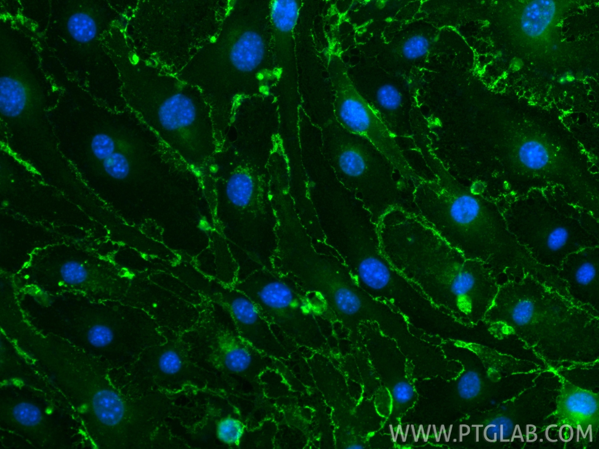Immunofluorescence (IF) / fluorescent staining of bEnd.3 cells using CoraLite® Plus 488-conjugated CD31 Recombinant ant (CL488-84607-4)