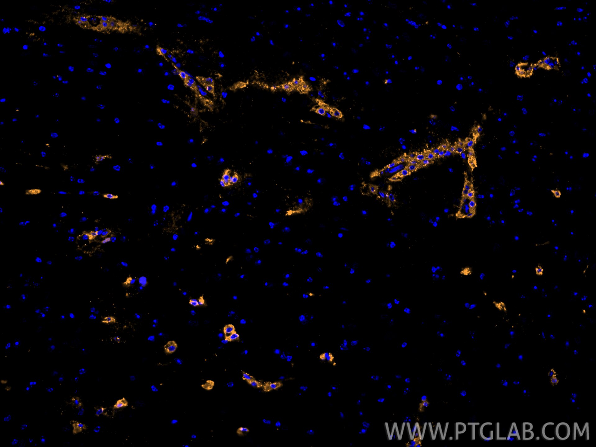 Immunofluorescence (IF) / fluorescent staining of mouse brain tissue using CoraLite® Plus 555-conjugated CD31 Polyclonal anti (CL555-28083)