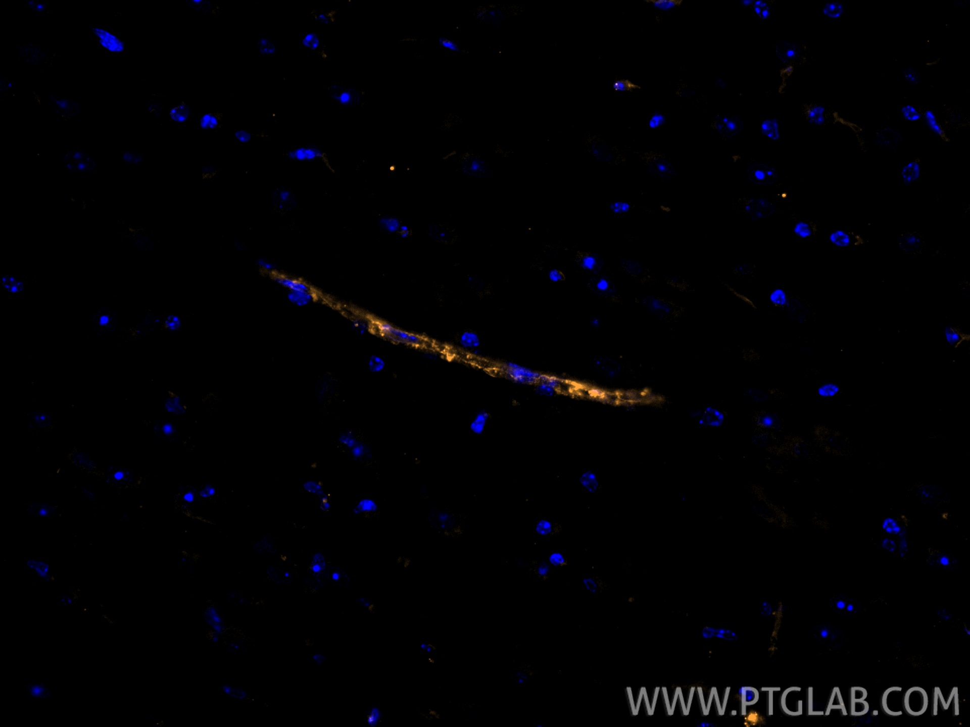 Immunofluorescence (IF) / fluorescent staining of mouse brain tissue using CoraLite® Plus 555-conjugated CD31 Polyclonal anti (CL555-28083)