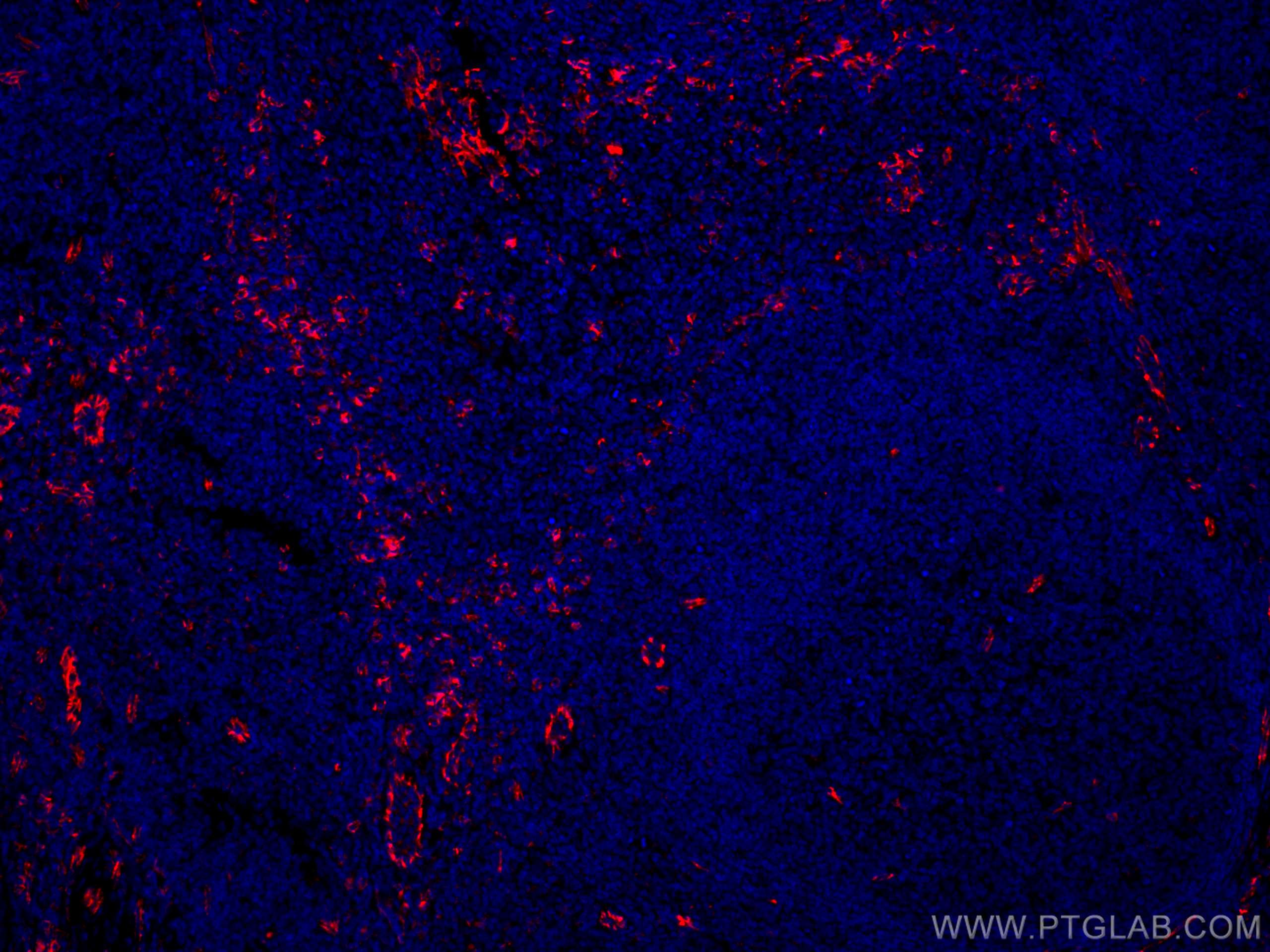 Immunofluorescence (IF) / fluorescent staining of human tonsillitis tissue using CoraLite®594-conjugated CD31 Polyclonal antibody (CL594-11265)
