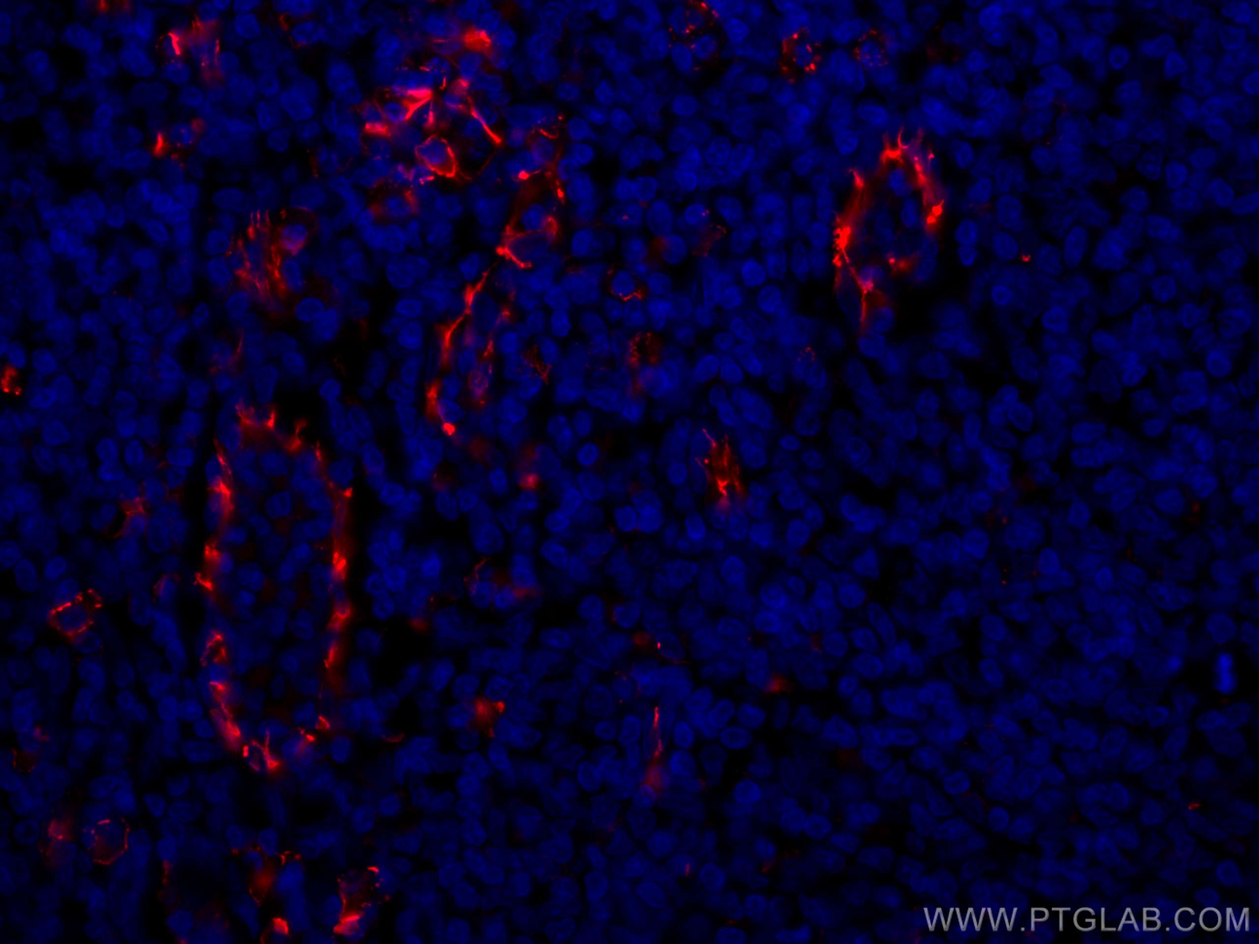 Immunofluorescence (IF) / fluorescent staining of human tonsillitis tissue using CoraLite®594-conjugated CD31 Polyclonal antibody (CL594-11265)