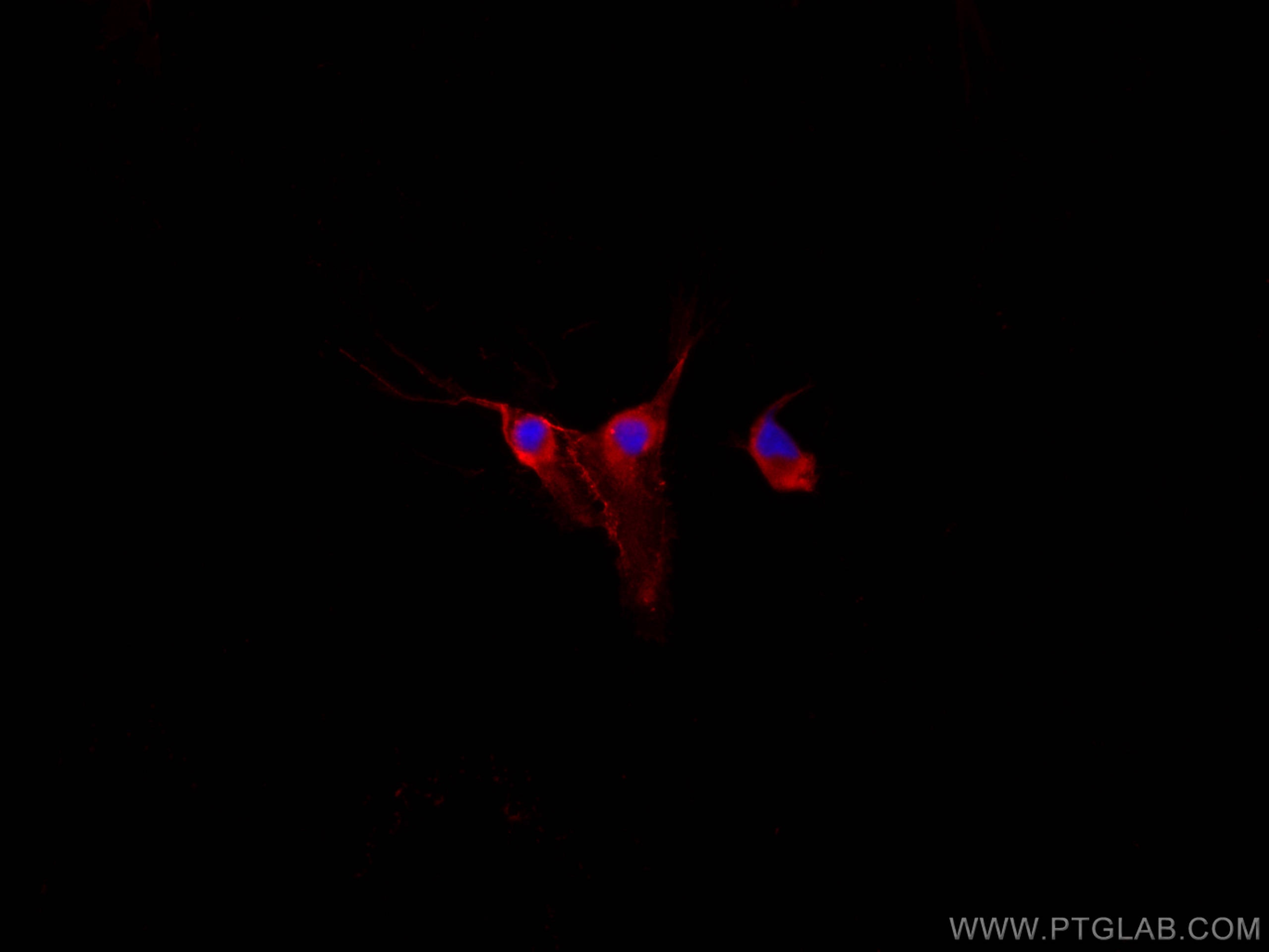 Immunofluorescence (IF) / fluorescent staining of HUVEC cells using CoraLite®594-conjugated CD31 Polyclonal antibody (CL594-11265)