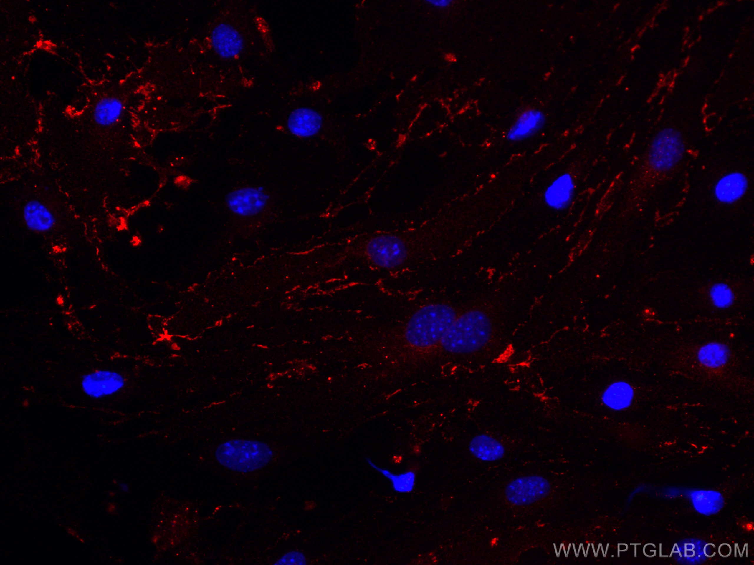 Immunofluorescence (IF) / fluorescent staining of bEnd.3 cells using CoraLite®594 Anti-Mouse CD31 (390) (CL594-65058)