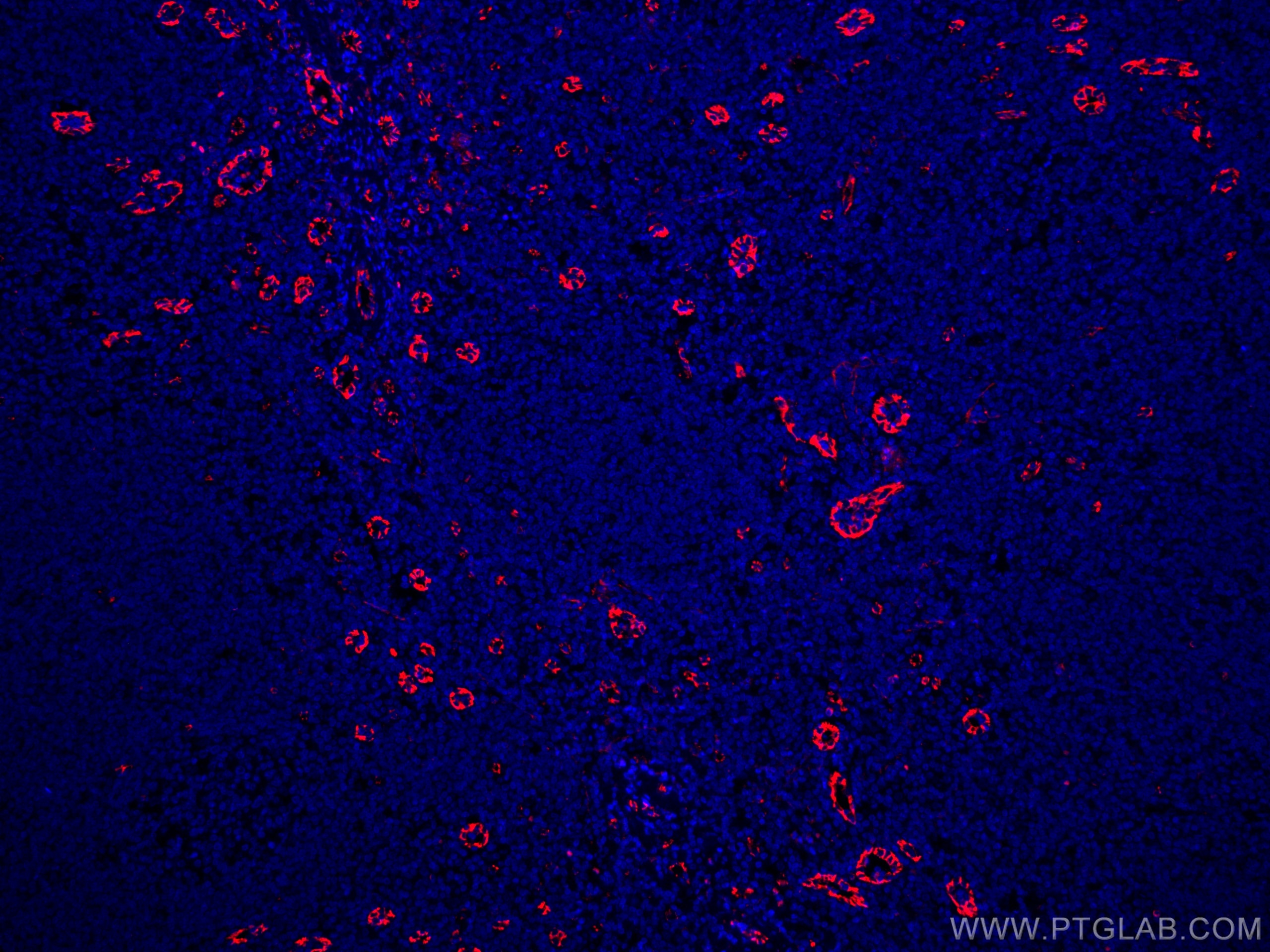 IF Staining of human tonsillitis using CL594-66065